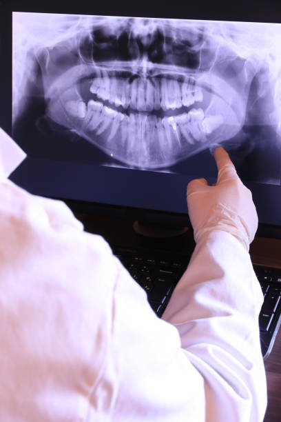 Best Emergency Dental Care for Sports Injuries in El Dorado, KS