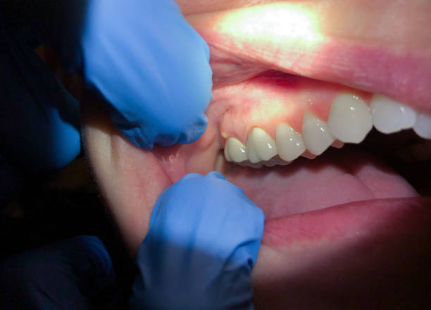Best Urgent Dental Care for Toothaches in El Dorado, KS